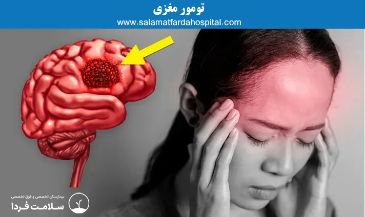 تومور مغزی