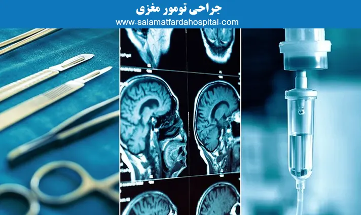 جراحی تومور مغزی