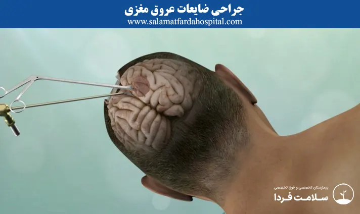 جراحی ضایعات عروق مغزی