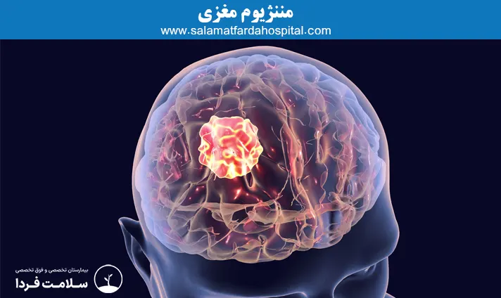 مننژیوم مغزی