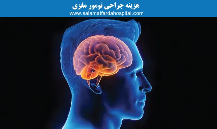 هزینه جراحی تومور مغزی