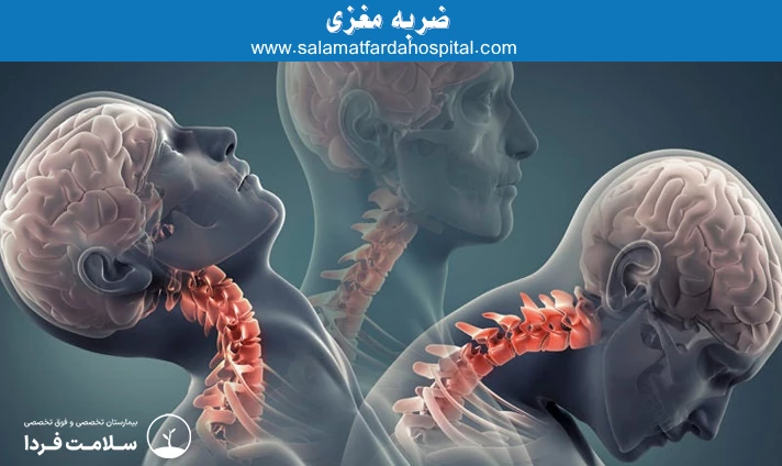 ضربه مغزی