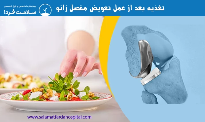تغذیه بعد از عمل تعویض مفصل زانو
