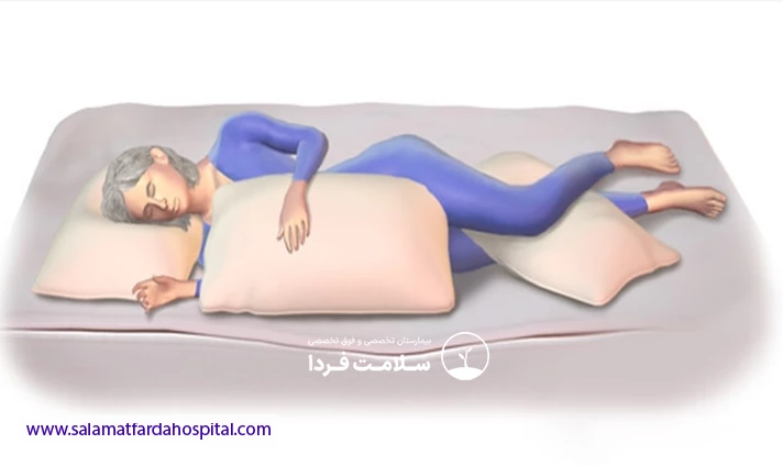 خوابیدن به پهلو بعد تعویض مفصل زانو