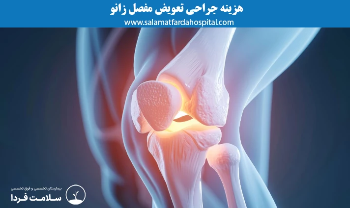 هزینه جراحی تعویض مفصل زانو