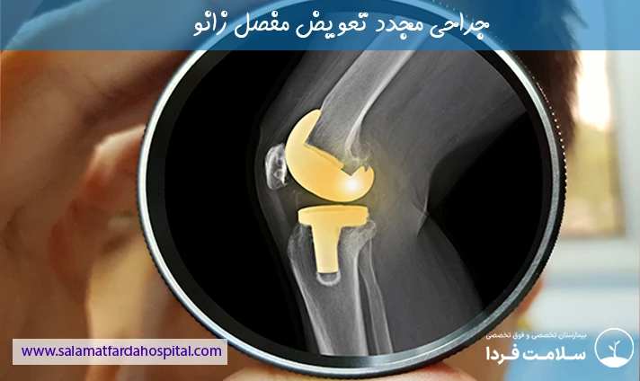 جراحی مجدد تعویض مفصل زانو