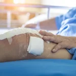 روش‌های ایمن برای نشستن و برخاستن از توالت بعد از عمل