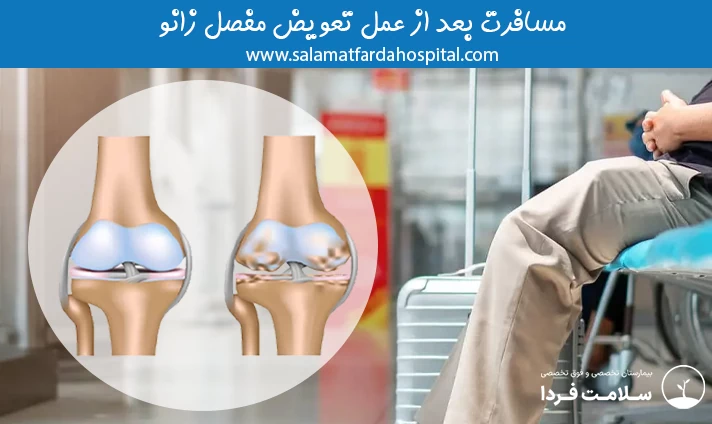 مسافرت بعد از عمل تعویض مفصل زانو