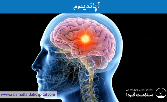آپاندیموم