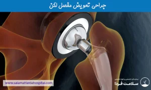 جراحی تعویض مفصل لگن