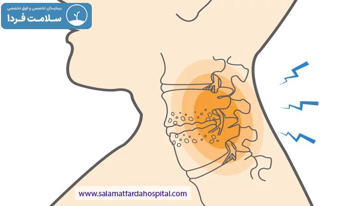 علائم تنگی کانال نخاع گردن