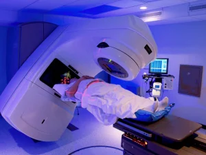 مزایای درمان سرطان با روش IMRT