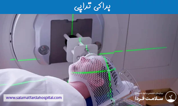 براکی تراپی