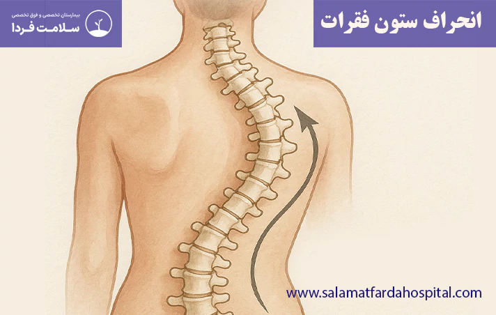 انحراف ستون فقرات